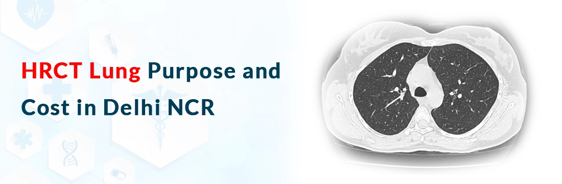 HRCT Lung: Purpose and Cost in Delhi NCR